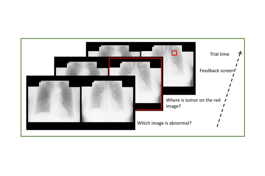 Chest X-rays from Dr. Jang's Article