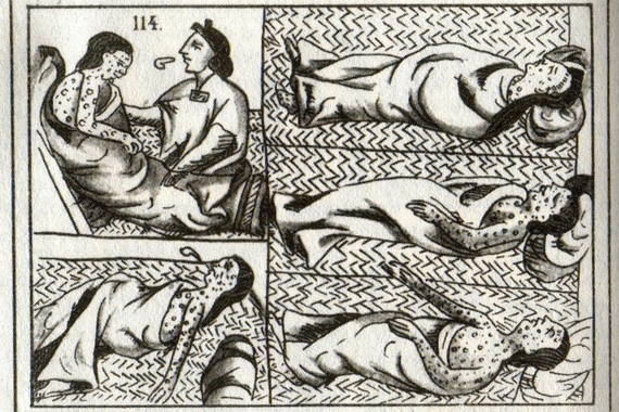 Early American Spanish Drawing of Smallpox
